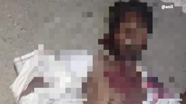 देेेवरिया: पननहा के पास अज्ञात वाहन की ठोकर से मोटरसाइकिल सवार दो लोग हुए घायल, जिला अस्पताल किया गया रेफर