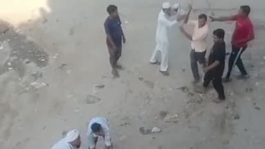 मुरादाबाद: करनपुर में जमीन के बंटवारे को लेकर दबंगों ने एक व्यक्ति के साथ लाठी-डंडों से की मारपीट व्यक्ति हुआ घायल