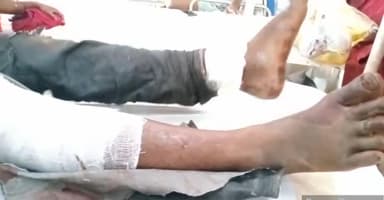 देवेंद्रनगर: कल्दा पहाड़ के अंधे मोड़ मे तेज रफ्तार कार और बाइक में हुई आमने-सामने ज़ोरदार भिड़ंत 40 वर्षीय मजदूर घायल जिला अस्पताल रेफर।