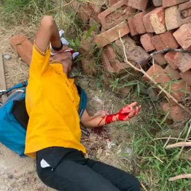 धनौरा: गजरौला टीटी फैक्ट्री के पास तेज दफ्तर अज्ञात वाहन की टक्कर से बाइक सवार घायल हालत गंभीर