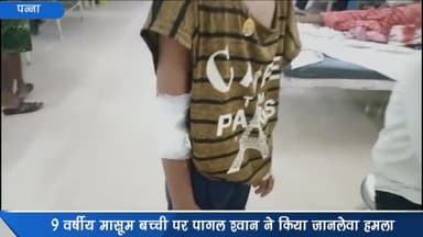 देवेंद्रनगर: 9 वर्षीय मासूम बच्ची पर गुन्नौर में पागल कुत्ते ने किया जानलेवा हमला, राहगीरों ने बचाई जान