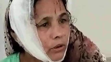 हिसार: छोटी सातरोड़ गांव में देवरानी ने सास के साथ मिलकर जेठानी के साथ की मारपीट, नागरिक हॉस्पिटल में कराया गया भर्ती