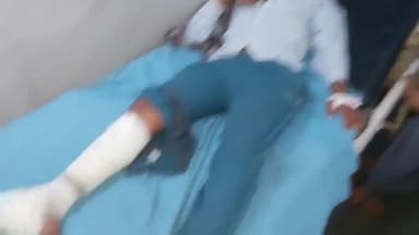 रामपुर: थाना टांडा क्षेत्र के मोहनपुरा में दो बाइकों की टक्कर में एक घायल जिला अस्पताल में भर्ती उपचार जारी