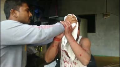 देेेवरिया: परासखंड गोरियाखास में रुपए को लेकर पति-पत्नी में हुआ विवाद , पत्नी ने पति का सर फोड़ा ऐ