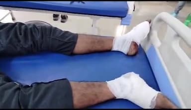 बरेली: शेरगढ़ थाना क्षेत्र निवासी एक व्यक्ति नींद की झपकी में ट्रेन में गिरकर हुआ घायल, जिला अस्पताल में कराया गया भर्ती