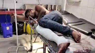 मुरादाबाद: लादावली में सड़क दुर्घटना में घायल अज्ञात व्यक्ति को पुलिस ने इलाज के लिए अस्पताल पहुंचाया