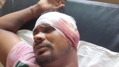 रामपुर: कृष्ण विहार मंदिर के निकट मांझे की चपेट में आने से युवक हुआ घायल, जिला अस्पताल में भर्ती