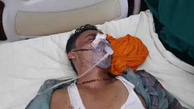 रामपुर: ग्राम पुरैना में मोटरसाइकिल अनियंत्रित होकर डिवाइडर से टकराई, हादसे में रक्षाबंधन पर ससुराल आया युवक हुआ घायल