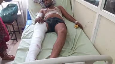 मुरादाबाद: बहजोई रोड पर पिकअप व बोलेरो गाड़ी की भिड़ंत में एक व्यक्ति हुआ गंभीर घायल, ज़िला अस्पताल में कराया गया भर्ती