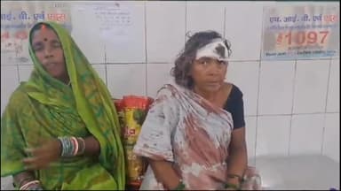 लखीसराय: जय नगर काली पहाड़ी पर आपसी विवाद को लेकर दो पक्षों में जमकर हुई मारपीट, एक पक्ष से दो लोग हुए ज़ख्मी