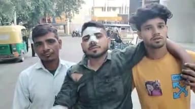 मुरादाबाद: सिविल लाइन थाना क्षेत्र में तेज रफ़्तार अज्ञात कार ने ओवरटेक करने के चलते बाइक मे मारी साइड से टक्कर बाइक सवार हुआ घायल