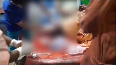 अररिया: जीरो माइल के समीप बाइक से अनियंत्रित होकर गिर जाने से महिला हुई घायल इलाज के लिए सदर अस्पताल में भर्ती