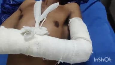 लाडपुरा: खातोली क्षेत्र में जटवाड़ा रोड पर पत्नी को ससुराल लेने जा रहा युवक सड़क दुर्घटना में हुआ घायल