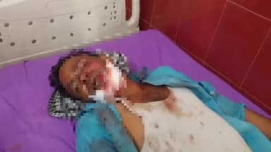 रामपुर: शहर कोतवाली क्षेत्र के काशीराम कॉलोनी में मजदूर खंभे पर चढ़कर पोल ठीक कर रहा था खंभे से मजदूर गिरकर घायल हुआ