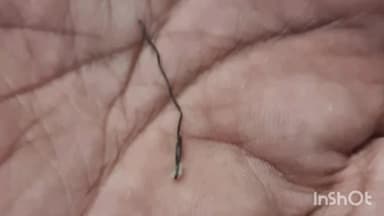 తాడేపల్లిగూడెం: పట్టణంలో ఉడిపి హోటల్ నుంచి తెప్పించిన టిఫిన్‌లో సూది సైజులోని పదునైన ఇనుప ఊచ లభ్యం, హోటల్‌పై చర్యలు తీసుకోవాలని డిమాండ్‌