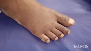 हाथरस: गांव तिपरस में चारा लेकर लौट रहे शख्स को सांप ने काटा, अचेत होकर जमीन पर गिरे शख्स को परिजन उपचार हेतु लाए जिला अस्पताल