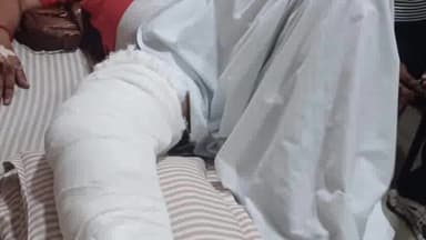 ਪਟਿਆਲਾ: ਪਾਤੜਾਂ ਚ ਨਸ਼ਾ ਤਸਕਰਾਂ ਨੂੰ ਫੜਨ ਗਈ ਪੁਲਸ ਤੇ ਚੜ੍ਹਾਈ ਥਾਰ ਗੱਡੀ ਘਟਨਾ 'ਚ ਪੁਲਿਸ ਮੁਲਾਜ਼ਮ 
ਜ਼ਖ਼ਮੀ