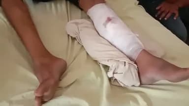 मुरादाबाद: गांव मिल्क की पुलिया के पास रंजिश के चलते 4 से 5 लोगों ने एक युवक पर किया हमला, घायल जिला अस्पताल में भर्ती