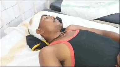 देवेंद्रनगर: ग्राम गंज में पुरानी रंजिश के चलते भाई-बहन को पीटा गया, भाई को प्राथमिक उपचार के बाद जिला चिकित्सालय किया गया रेफर