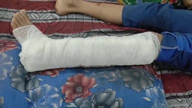 फर्रुखाबाद: अमानाबाद में गली क्रॉस कर रहे कोचिंग जा रहे छात्र को बाइक सवार ने मारी टक्कर, गंभीर हालत में जिला अस्पताल में भर्ती