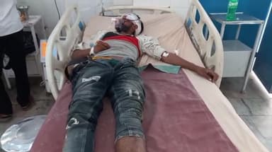 मुरादाबाद: संभल जिले में सड़क दुर्घटना में घायल हुए युवक को मुरादाबाद के जिला अस्पताल में कराया गया भर्ती