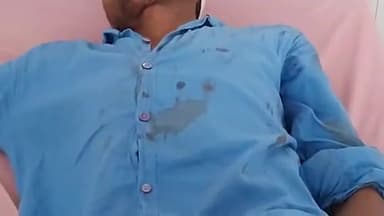 मुरादाबाद: लोदीपुर में मजदूरी कर घर लौट रहे व्यक्ति को तेज रफ्तार बाइक ने मारी टक्कर, मजदूर हुआ घायल