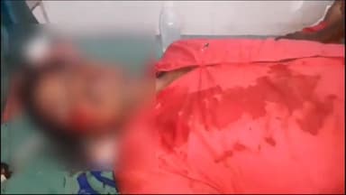 अररिया: गैयारी यादब चौक के समीप अनियंत्रित बाइक की चपेट में आने से एक युवक हुआ घायल, सदर अस्पताल में भर्ती