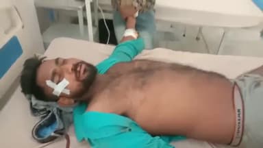 मुरादाबाद: हसनपुर संभल रोड पर तेज रफ्तार कार ने एक बाइक पर सवार 3 मजदूरों को मारी टक्कर, हादसे में 2 मजदूरों की हुई मौत व एक घायल