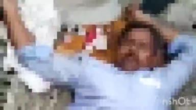 एत्मादपुर: गांव नगला ताज में हाईटेंशन लाइन ठीक करने के दौरान लाइनमैन को लगा करंट, एक हाथ बुरी तरह झुलसा