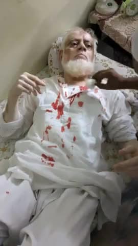 #बेगूसराय के मशहूर #फिजिशियन #डॉक्टर #शौकत अली  के #किलनिक में घुस एक व्यक्ति ने धारदार #हथियार से हमला। कर दिया।