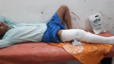 सासाराम: गौरक्षणी मोहल्ले में अनियंत्रित बाइक की टक्कर से एक व्यक्ति हुआ घायल, सदर अस्पताल के ट्रॉमा सेंटर में इलाज जारी