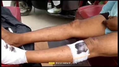 हसनपुर: सैदनगली थाने के नज़दीक स्कूल बस ने पीछे से मयूरी में मारी जोरदार टक्कर, चालक हुआ गंभीर घायल