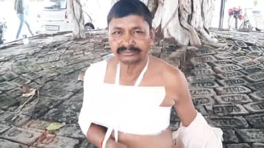 सासाराम: सीढ़ी गांव में आपसी विवाद को लेकर दो पक्षों में हुई मारपीट, एक व्यक्ति घायल