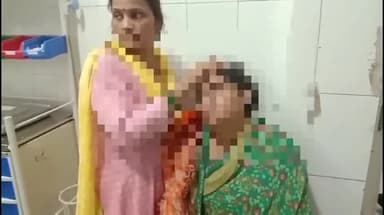 मुरादाबाद: लाइनपार में घरेलू विवाद के चलते देवर ने अपनी भाभी के साथ लाठी-डंडों से की मारपीट, उपचार के लिए लाया गया जिला अस्पताल