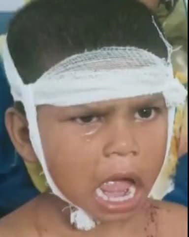 हसनपुर: फूलपुर बिजलपुर में मां के साथ बाग से लड़कियां तोड़ने गई मासूम पर कुत्तों के झुंड ने बोला हमला, हालत गंभीर