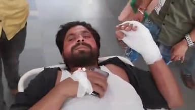 मुरादाबाद: लाजपतनगर में घर की छत से सामान उतारने गए एक युवक पर करीब 10 बंदरों ने किया हमला, छत से नीचे फेंका