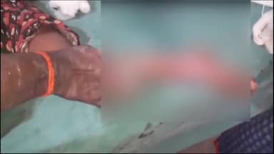 अररिया: बैरियर दियारी मार्ग पर बाइक की टक्कर से एक बच्ची हुई घायल, सदर अस्पताल में कराया गया भर्ती