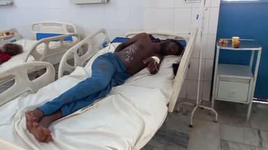 मुरादाबाद: रेलवे स्टेशन पर झुलसी हालत में मिला एक युवक, उपचार के लिए पुलिस द्वारा जिला अस्पताल में कराया गया भर्ती