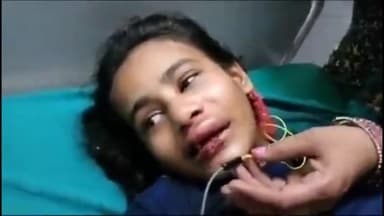 गाज़ियाबाद: क्रॉसिंग रिपब्लिक थाना क्षेत्र के सेन विहार में महिला ने घर की छत से किशोरी को दिया धक्का, किशोरी घायल