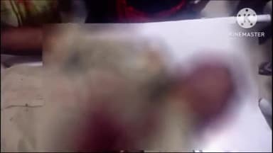 सुल्तानपुर: द्वारिकागंज के पास अनियंत्रित पिकअप की चपेट में आया एक पीआरडी का जवान, जिला अस्पताल में चिकित्सकों ने किया मृत घोषित