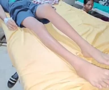 सिमडेगा: करवारजोर में जहरीले सांप के काटने से एक बच्चे की बिगड़ी हालत