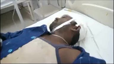 पवई: ग्राम मुराछ में शराब के नशे में धुत्त बाइक सवार हुआ सड़क हादसे में घायल, जिला अस्पताल किया गया रेफर