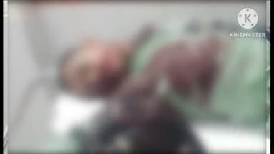 ଗୋଲାମୁଣ୍ଡା: ସନ୍ଧିକୂଳେର ନିକଟରେ ୨ ବାଇକ ମୁହାଁମୁହିଁ ଧକ୍କା; ଜଣେ ମୃତ, ଜଣେ ଗୁରୁତର