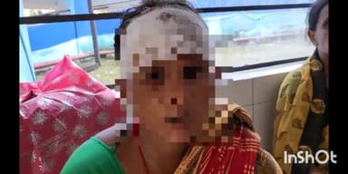 सुपौल: बायसी में भैंस बांधने के विवाद को लेकर की गई मारपीट में एक महिला हुई जख्मी, सदर अस्पताल में इलाज जारी