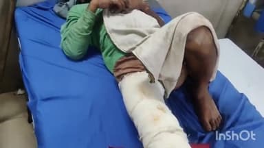 लाडपुरा: कापरेन थाना क्षेत्र के गरजनी गांव में शराब पार्टी के दौरान झगड़ा होने पर युवक का लाठी मारकर पैर तोड़ा MBSअस्पताल में भर्ती