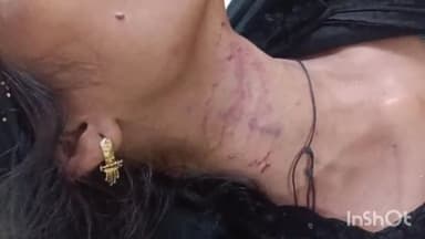 एटा: कोतवाली नगर के इस्लामनगर में पति ने विवाहिता के साथ की मारपीट, मेडिकल कॉलेज में भर्ती