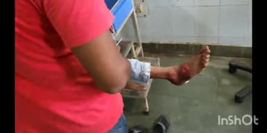 सुपौल: आरएसएम पब्लिक स्कूल के समीप मोटरसाइकिल अनियंत्रित होकर गिरने से एक युवक जख्मी सदर अस्पताल सुपौल में इलाजरत