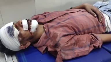 अम्बाला: देवी नगर के नजदीक मोटरसाइकिल चालक को कार ने मारी टक्कर इलाज के लिए लाया नागरिक अस्पताल