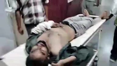 मुरादाबाद: दलपतपुर टोल टैक्स के पास बाइक चालक को नींद की झपकी आने पर बाइक डिवाइडर में घुसी, 4 लोग गंभीर रूप से घायल