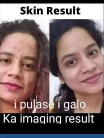 स्किन प्रॉब्लम के लिये संपर्क करे 8708104853
#news24 #news #news_ #rewari #bawal #kosli #delhi #gurugram #palval#noida